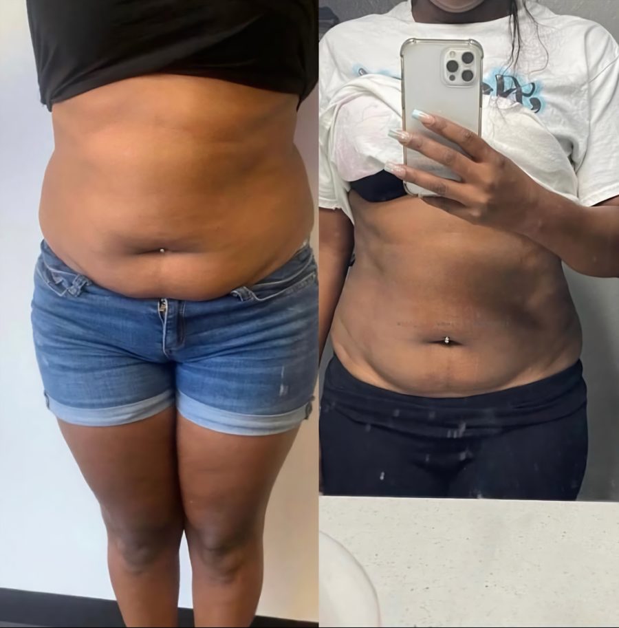 15 Day Tummy Fat Burner photo 4